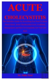 Acute Cholecystitis