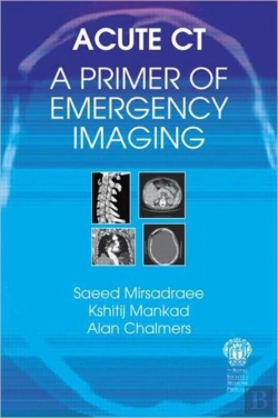 Bertrand.pt - Acute Ct: A Primer Of Emergency Imaging