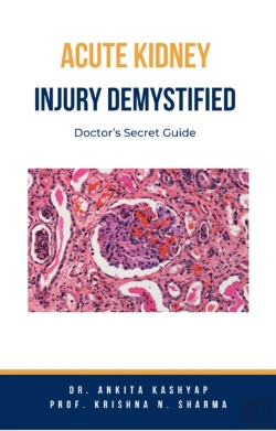Bertrand.pt - Acute Kidney Injury Demystified: Doctor'S Secret Guide