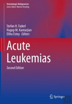 Bertrand.pt - Acute Leukemias