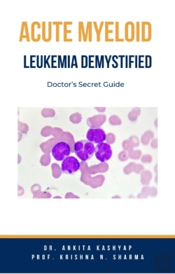 Bertrand.pt - Acute Myeloid Leukemia Demystified: Doctor'S Secret Guide