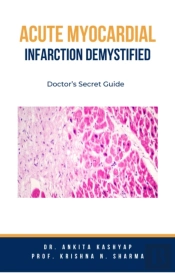Acute Myocardial Infarction Demystified: Doctor'S Secret Guide