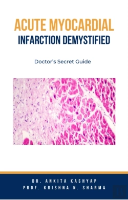 Bertrand.pt - Acute Myocardial Infarction Demystified: Doctor'S Secret Guide