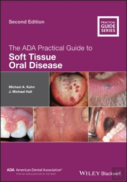 Bertrand.pt - Ada Practical Guide To Soft Tissue Oral Disease
