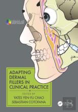 Adapting Dermal Fillers In Clinical Practice