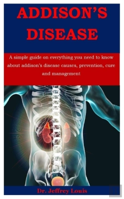 Bertrand.pt - Addison'S Disease