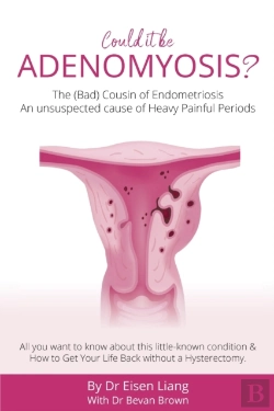 Bertrand.pt - Adenomyosis -The Bad Cousin Of Endometriosis