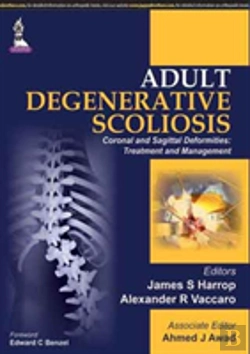 Bertrand.pt - Adult Degenerative Scoliosis