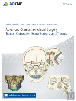 Bertrand.pt - Advanced Craniomaxillofacial Surgery