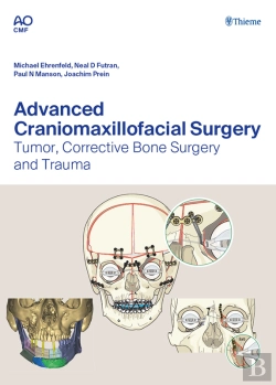 Bertrand.pt - Advanced Craniomaxillofacial Surgery