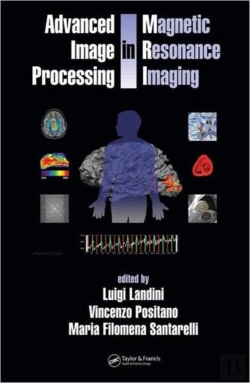 Bertrand.pt - Advanced Image Processing In Magnetic Resonance Imaging
