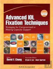Advanced Iol Fixation Techniques