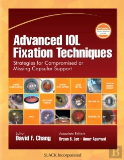 Bertrand.pt - Advanced Iol Fixation Techniques