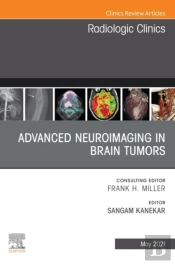Advanced Neuroimaging In Brain Tumors, An Issue Of Radiologic Clinics Of North America, E-Book