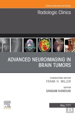 Bertrand.pt - Advanced Neuroimaging In Brain Tumors, An Issue Of Radiologic Clinics Of North America, E-Book