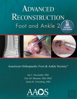 Bertrand.pt - Advanced Reconstruction: Foot And Ankle 2: Print + Ebook