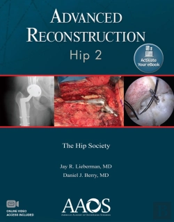 Bertrand.pt - Advanced Reconstruction: Hip 2: Print + Ebook With Multimedia