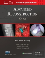 Advanced Reconstruction: Knee: Print + Ebook With Multimedia