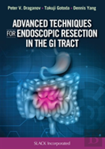 Advanced Techniques For Endoscopic Resection In The Gi Tract