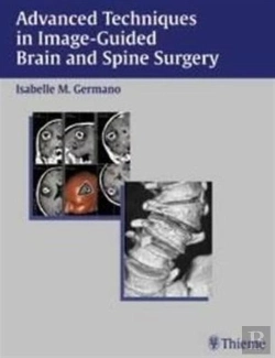 Bertrand.pt - Advanced Techniques In Image-Guided Brain And Spine Surgery