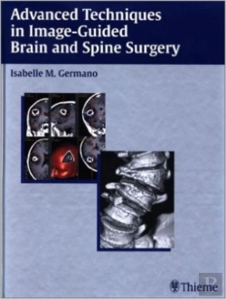 Bertrand.pt - Advanced Techniques In Image-Guided Brain And Spine Surgery