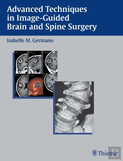 Bertrand.pt - Advanced Techniques In Image-Guided Brain And Spine Surgery