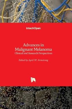 Bertrand.pt - Advances In Malignant Melanoma