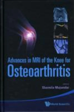 Bertrand.pt - Advances In Mri Of The Knee For Osteoarthritis