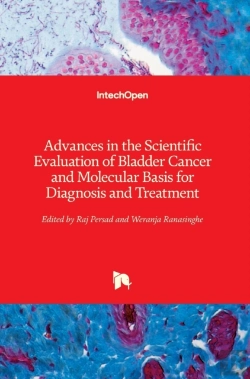 Bertrand.pt - Advances In The Scientific Evaluation Of Bladder Cancer And Molecular Basis For Diagnosis And Treatment