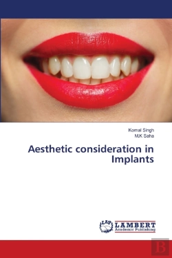 Bertrand.pt - Aesthetic Consideration In Implants