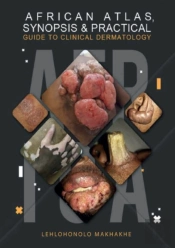 African Atlas, Synopsis & Practical Guide To Clinical Dermatology