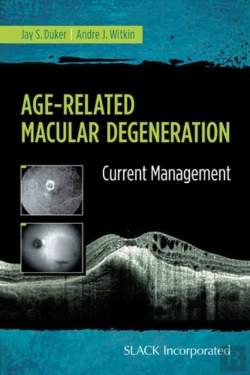 Bertrand.pt - Age-Related Macular Degeneration