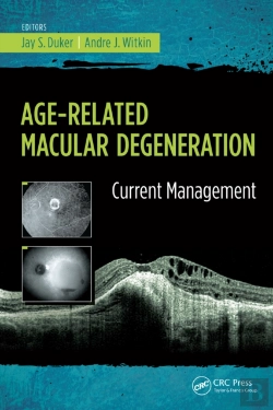 Bertrand.pt - Age-Related Macular Degeneration