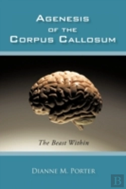 Bertrand.pt - Agenesis Of The Corpus Callosum