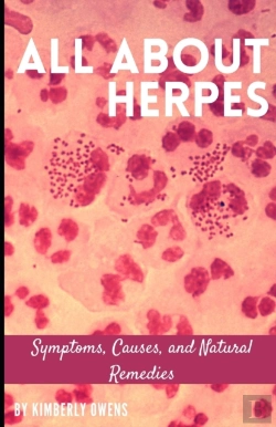 Bertrand.pt - All About Herpes