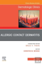 Allergic Contact Dermatitis,An Issue Of Dermatologic Clinics - E-Book