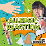 Allergic Reaction