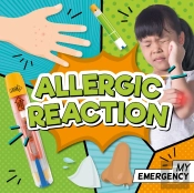 Allergic Reaction