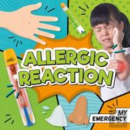 Allergic Reaction