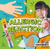 Allergic Reaction