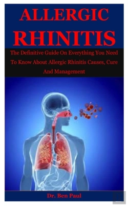 Bertrand.pt - Allergic Rhinitis