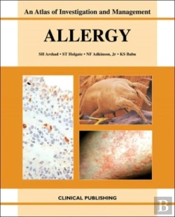 Bertrand.pt - Allergy