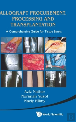 Bertrand.pt - Allograft Procurement, Processing And Transplantation: A Comprehensive Guide For Tissue Banks