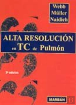 Bertrand.pt - Alta Resolucion En Tc De Pulmon