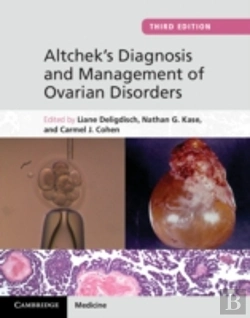 Bertrand.pt - Altchek'S Diagnosis And Management Of Ovarian Disorders