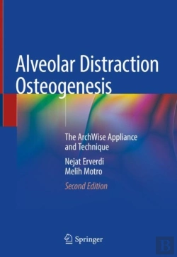 Bertrand.pt - Alveolar Distraction Osteogenesis