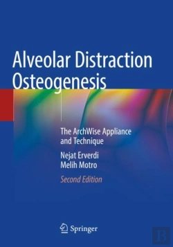 Bertrand.pt - Alveolar Distraction Osteogenesis