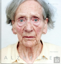 Bertrand.pt - Alzheimer