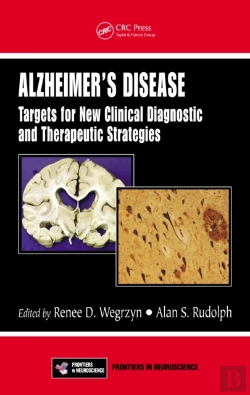 Bertrand.pt - Alzheimer'S Disease