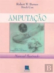 Amputação